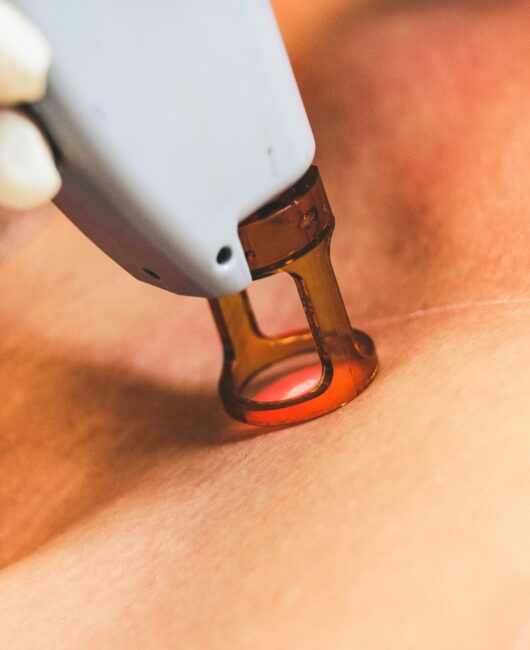 Laser dermatologo Laser dermatologo