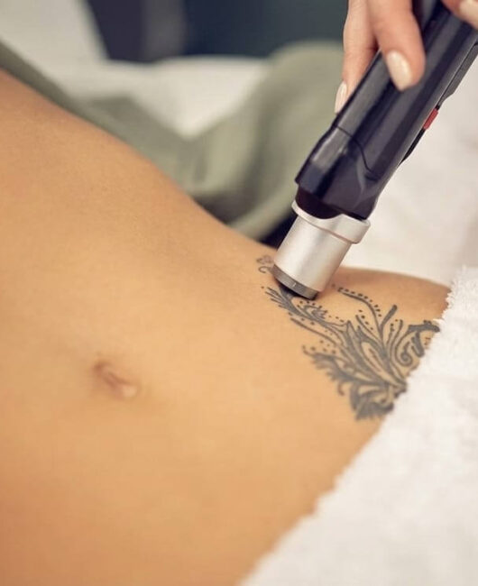 Procedura laser Procedura laser